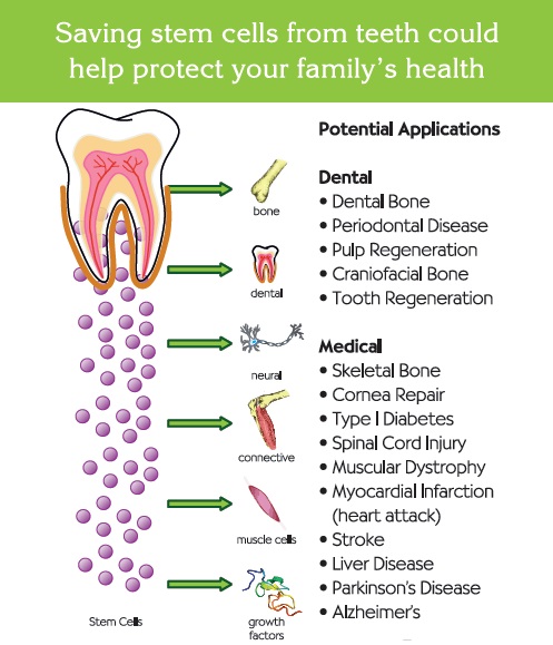 Stem Cell Banking benefits